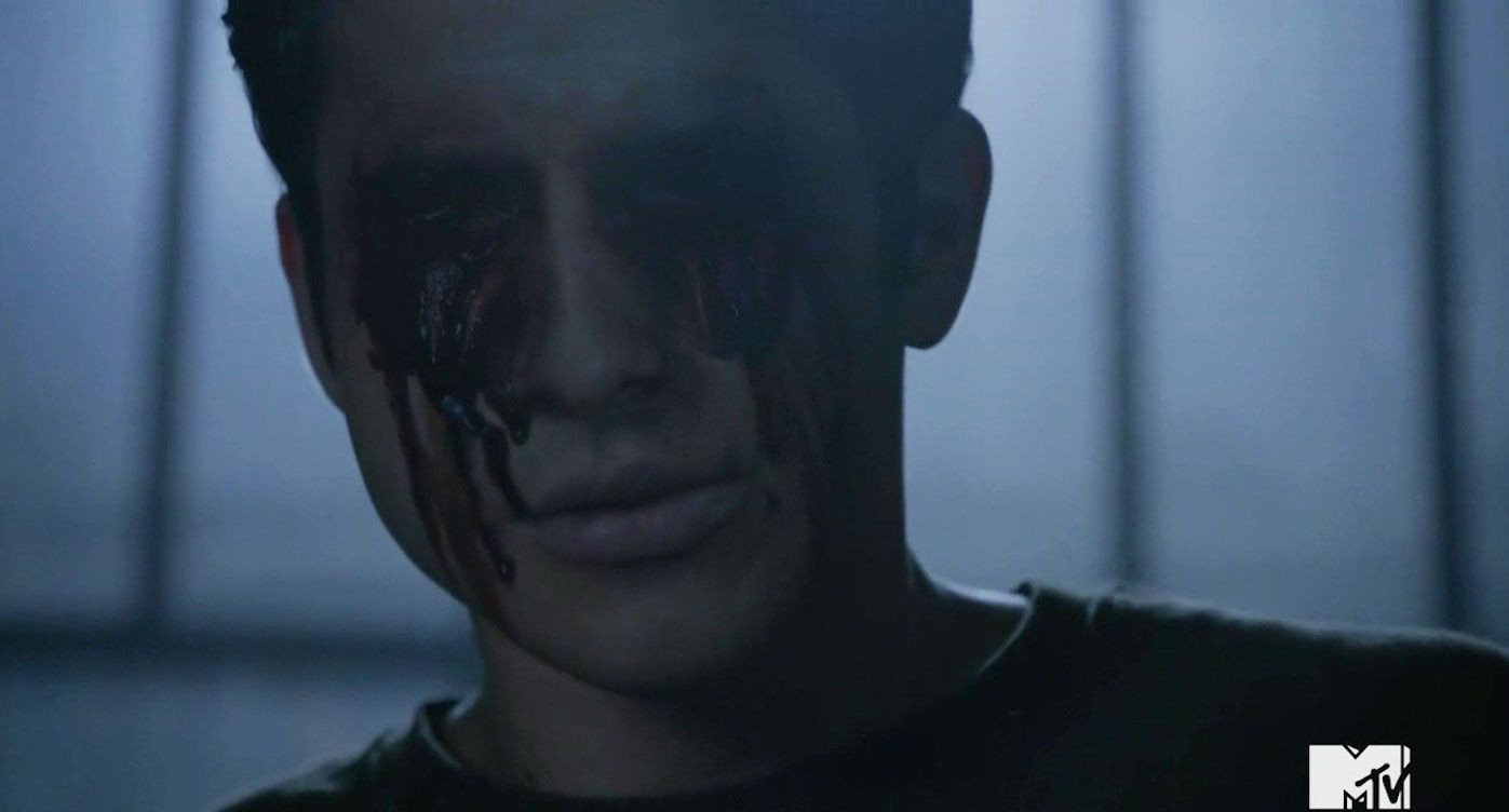 Tyler-Posey-Scott-McCall-Blinded-in-Teen-Wolf-Season-6b-Episode-20-The-Wolves-of-War