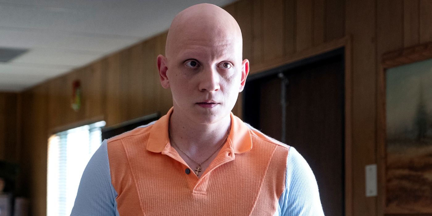 Barry': Anthony Carrigan on alopecia, discouraged in acting