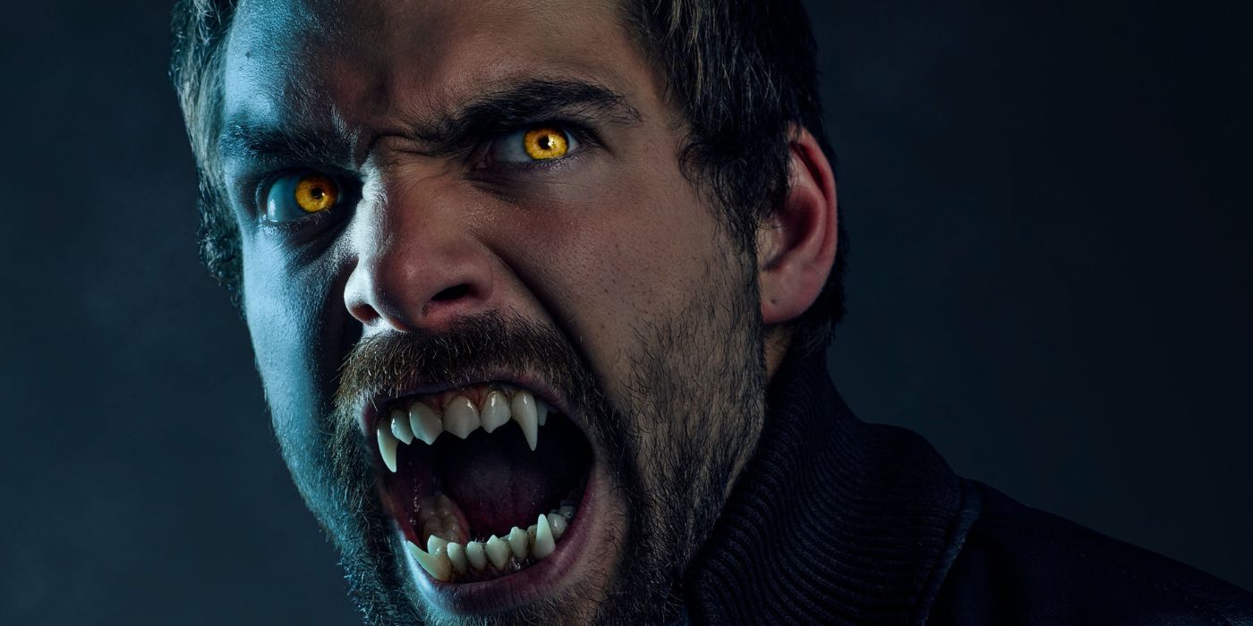 teen-wolf-movie-liam-dunbar