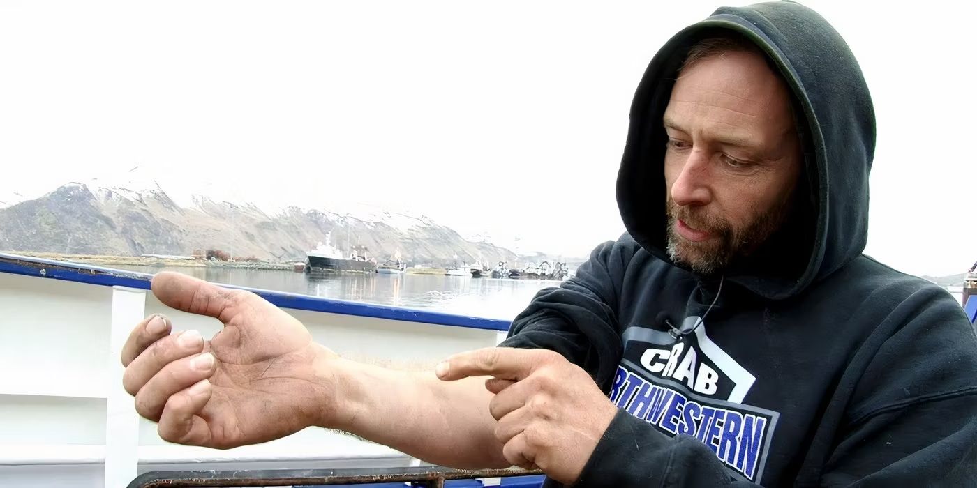 Edgar Hansen shows his arm on 'Deadliest Catch.'