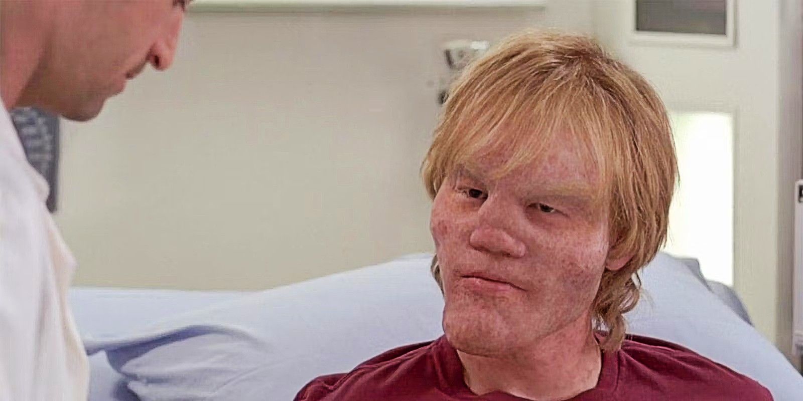 Jesse Plemons as a patient with lionitis in Grey's Anatomy