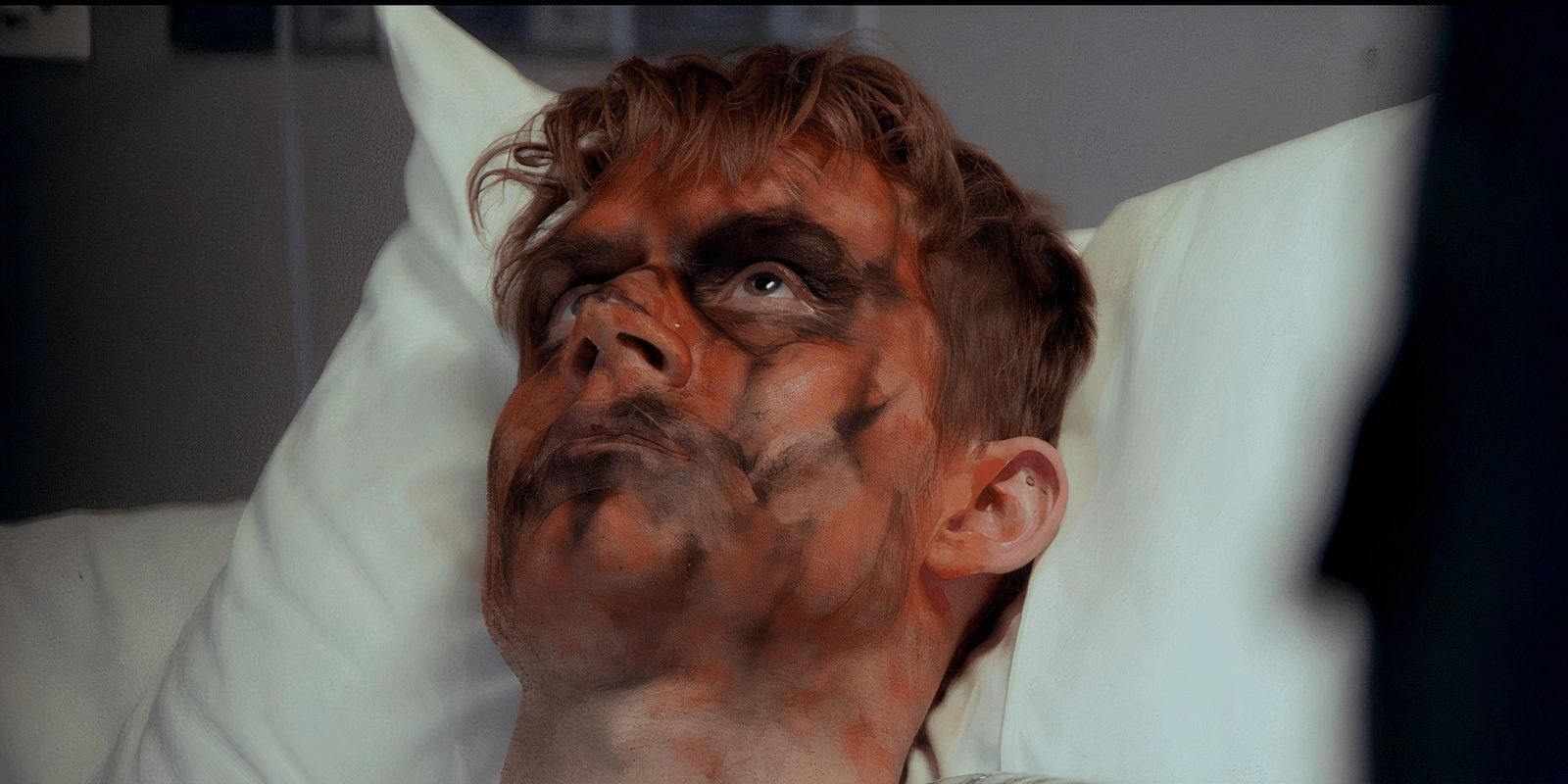 Thom Niemann como Patrick Weaver deitado em uma cama de hospital coberto com pintura facial de Halloween em Trick