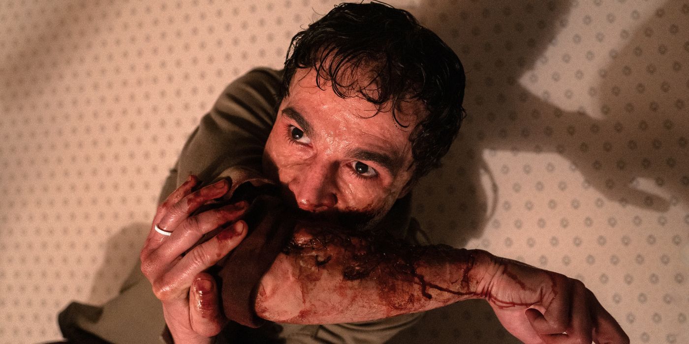 Christopher Abbott as Blake holding his scarred up arm in Wolf Man.