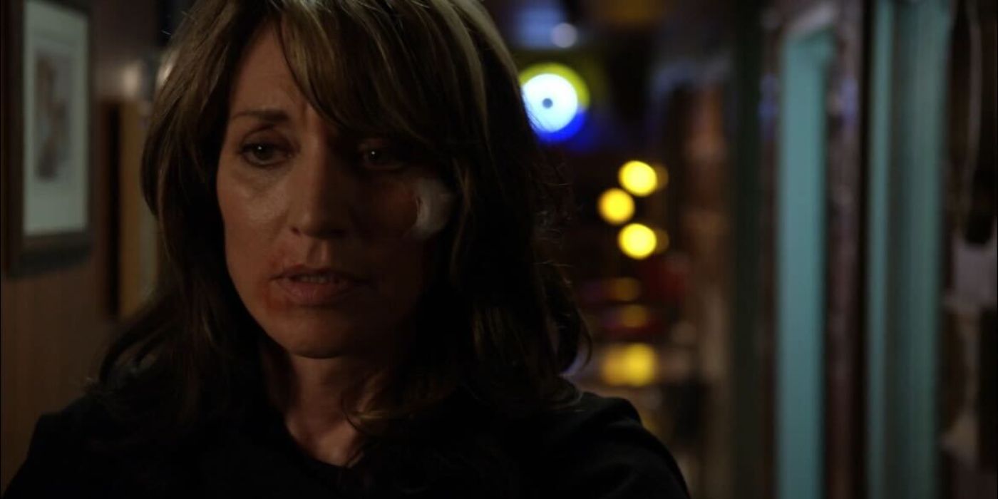 Gemma Teller in Season 2 of Sons of Anarchy with cuts and bandages on her face. 