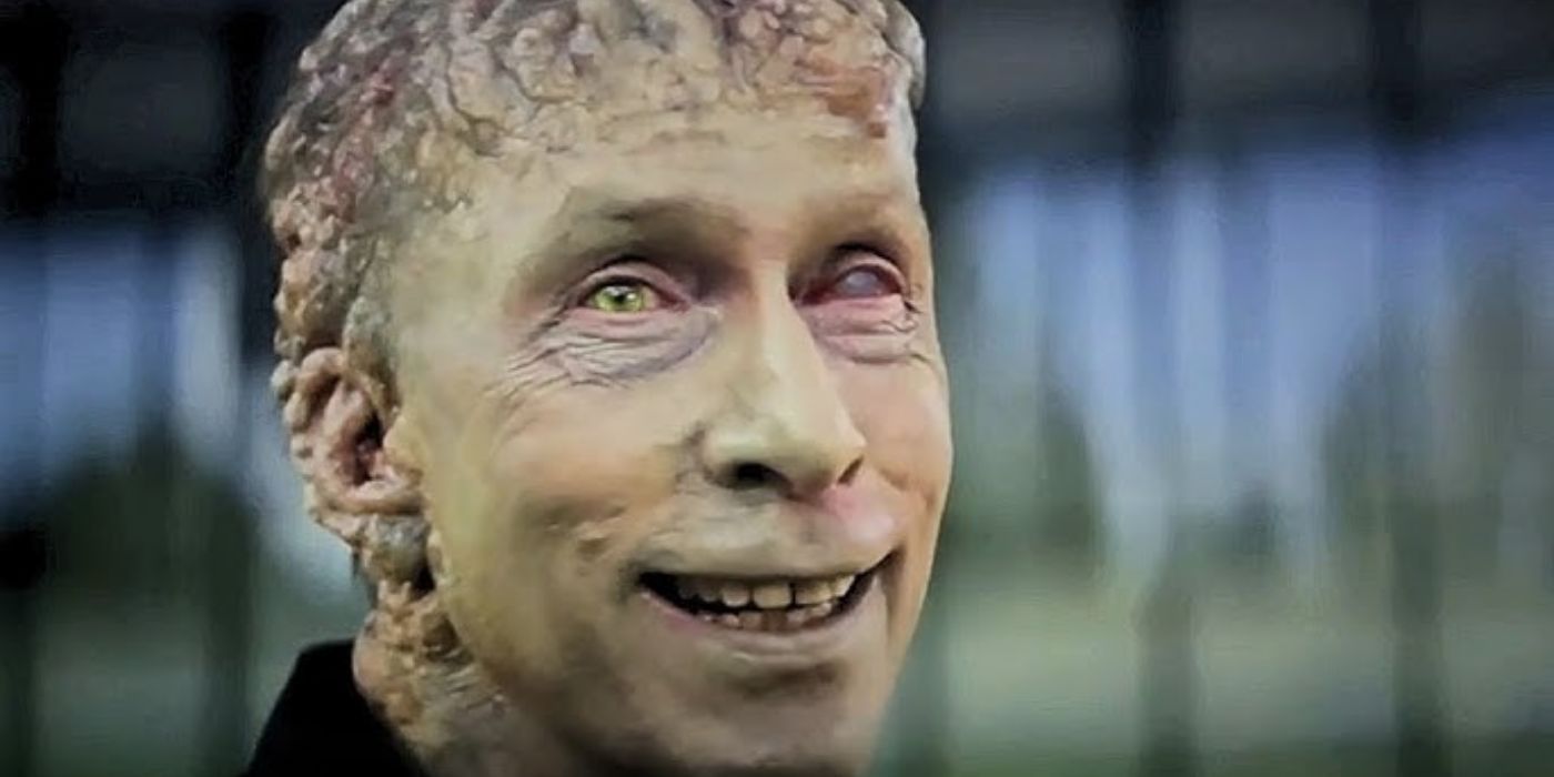 Tim Blake Nelson as Samuel Sterns with skin growths and abnormal eyes in Captain America: Brave New World.
