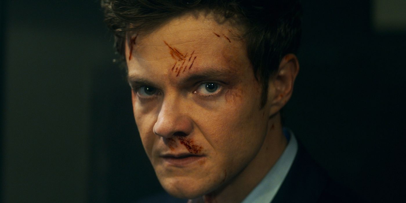 Close-up of Jack Quaid with scratches on his face in Novocaine