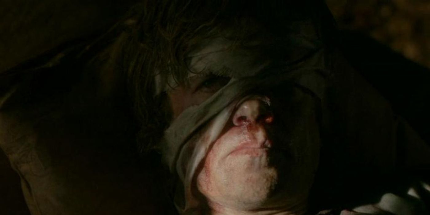 Tyrion Lannister with a bandage across his face in Game of Thrones