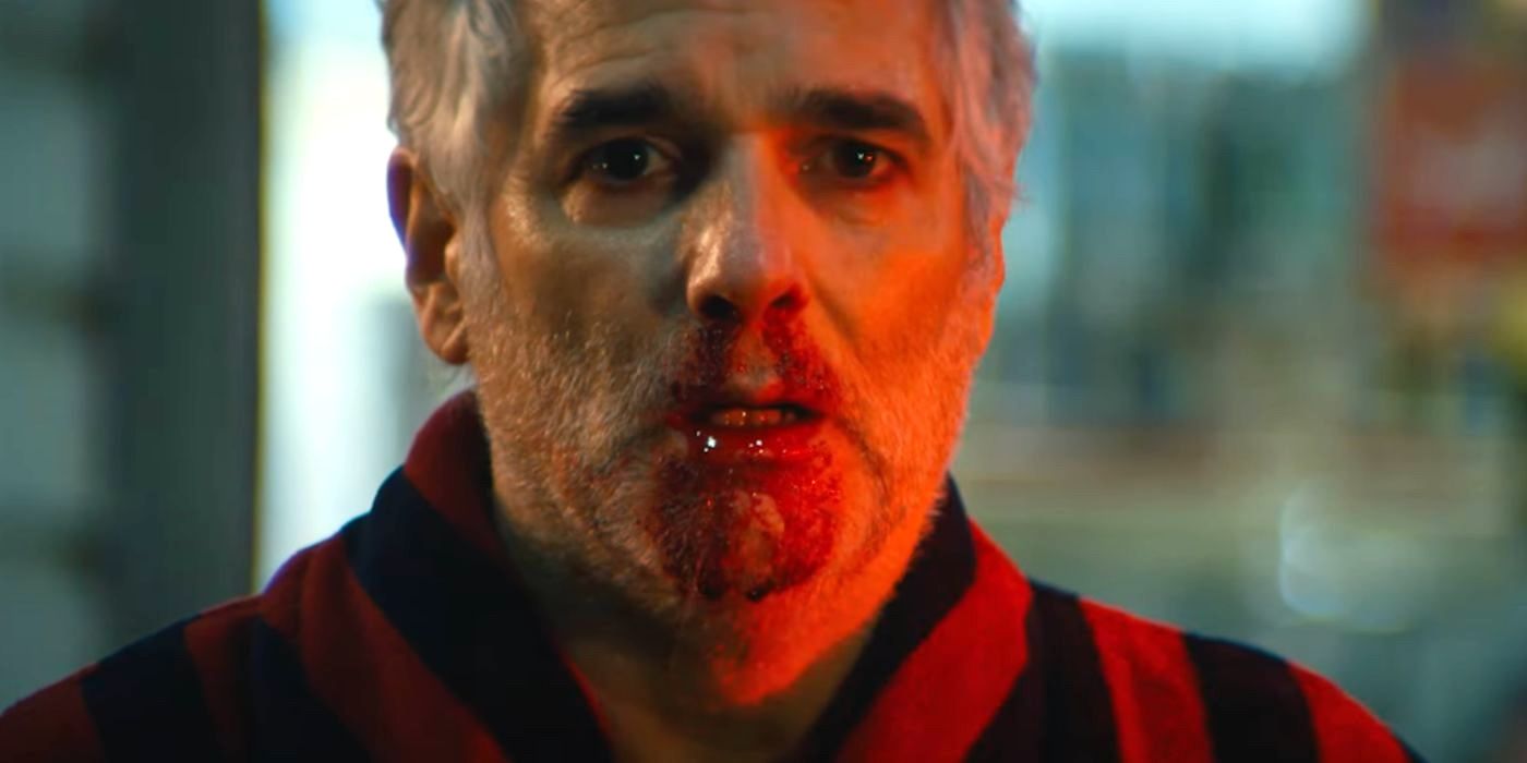 Petey (Yul Vazquez) has a bloody nose as he suffers from reintegration complications in Season 1 of Severance.