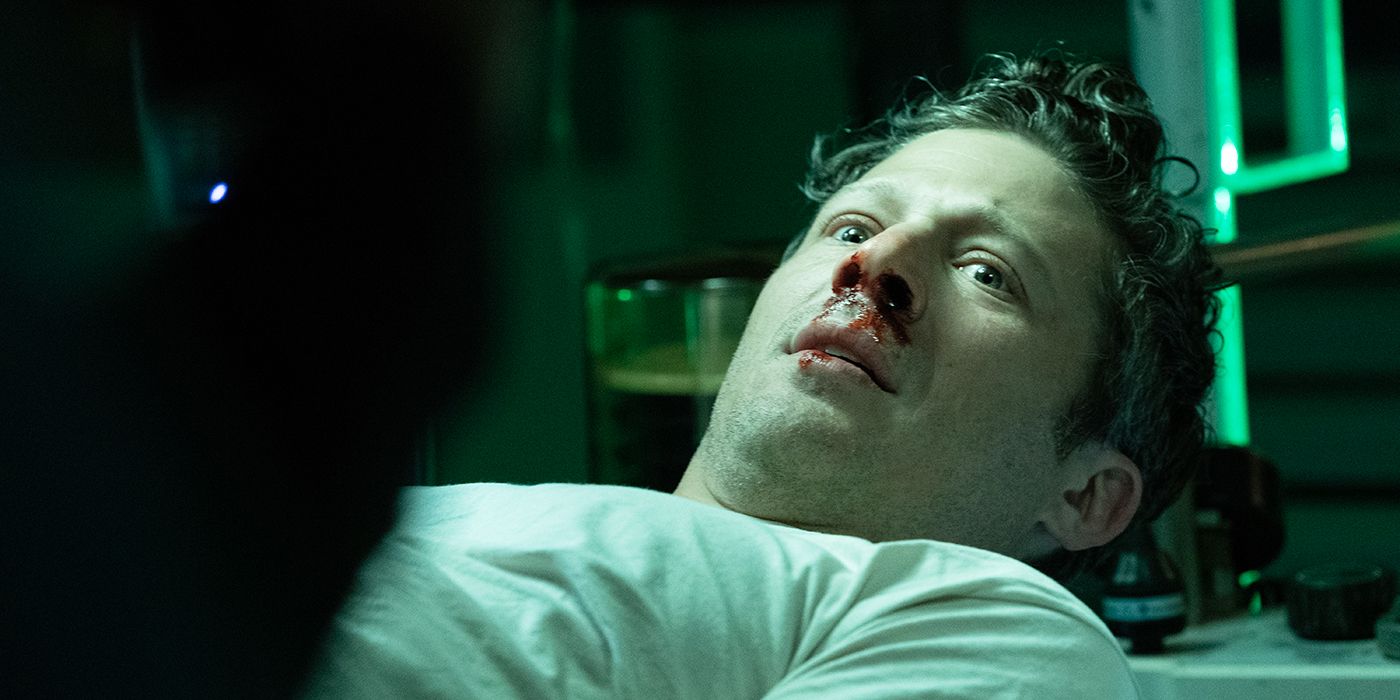 Zach Gilford with a bloody nose staring in surprise in Criminal Minds 